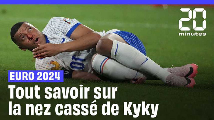 Euro 2024 : Les images du nez cassé de Kylian Mbappé et tout savoir sur la suite
